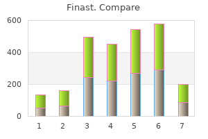 buy finast 5mg lowest price