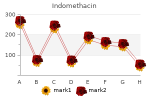buy indomethacin 25 mg on-line