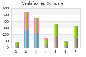 generic 75mg venlafaxine mastercard