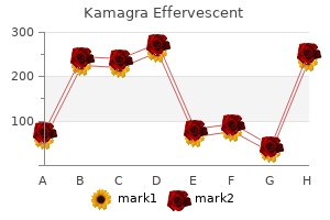 generic kamagra effervescent 100mg fast delivery