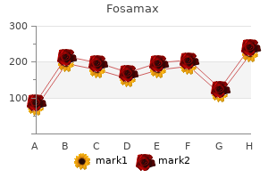 fosamax 70mg low price