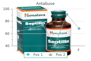 discount antabuse 250 mg fast delivery