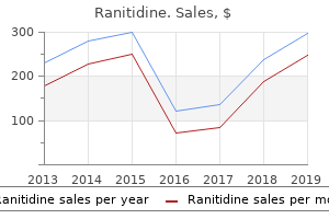 order ranitidine 150mg mastercard
