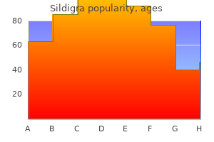 50mg sildigra amex