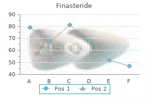 finasteride 1mg mastercard