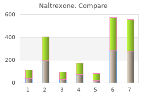 safe 50 mg naltrexone